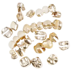 Wie sicher ist der Verkauf von Zahngold in Hannover? – Risiken, Schutz & seriöse Händler